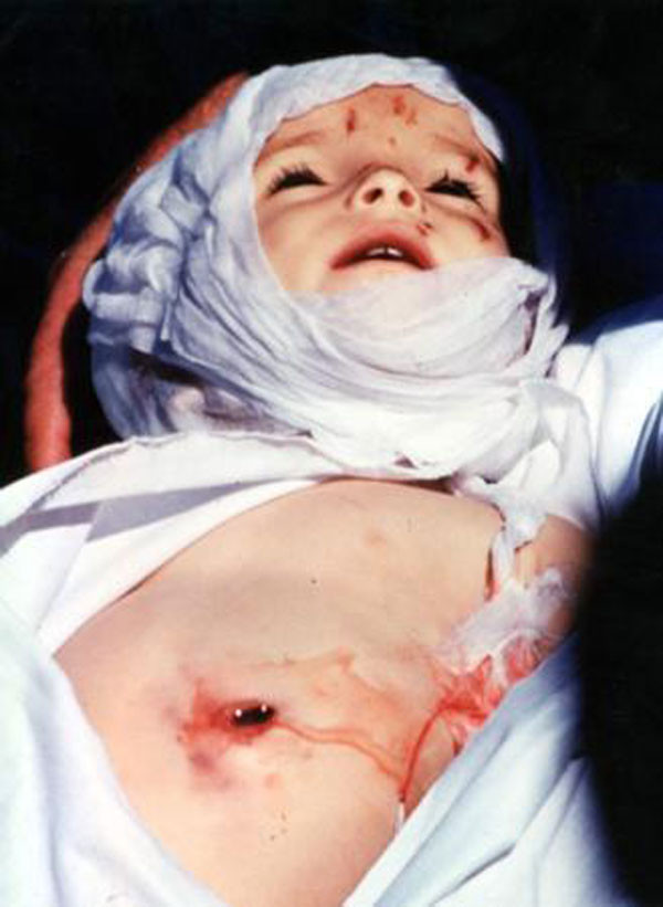 İşte PKK'nın katlettiği bebekler! Son kurban Bedirhan... - Resim: 4