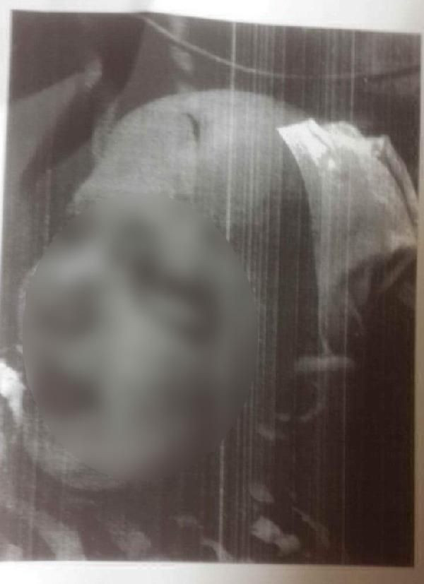 Mira bebeğe öz annesinden çamaşır sulu işkence - Resim: 2