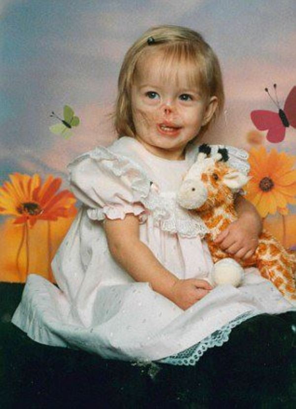 3 aylıkken yüzünü rakun parçaladı 11 yıl sonra ise... - Resim: 2