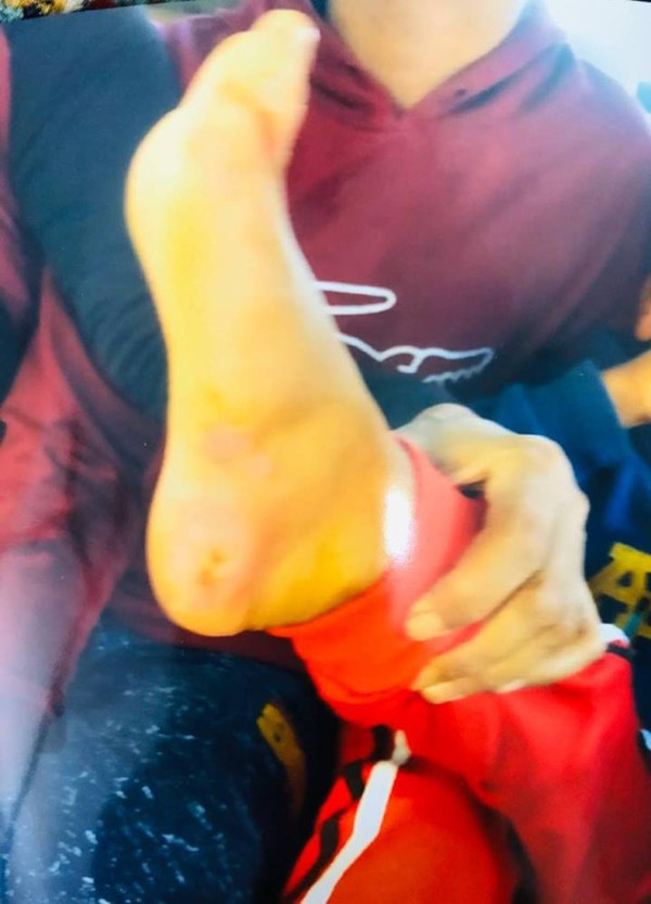 Şanlıurfa'da kan donduran olay! 'Oğlumu iple bağlayıp işkence ediyor' - Resim: 2