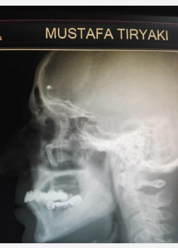 Başından mermi çıktı! Trabzon'da 43 yıl sonra karar çıktı: Ölsem de gözüm açık gitmez - Resim: 1