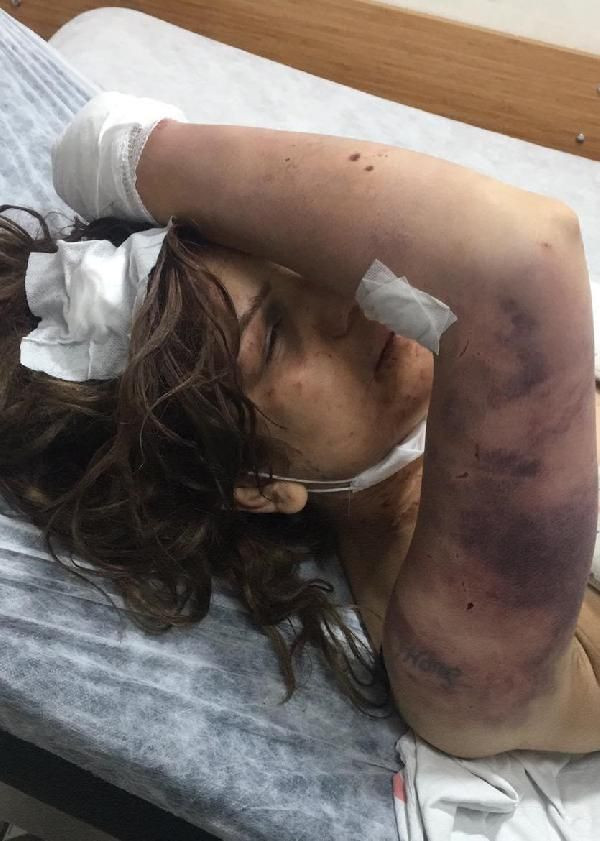 Şanlıurfa'da tırnakları sökülüp günlerce işkence görmüştü yeni gelişme - Resim: 1