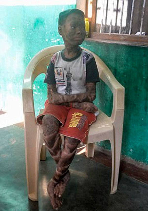 Dünya onu konuşuyordu yılan kızın son haline bakın - Resim: 3