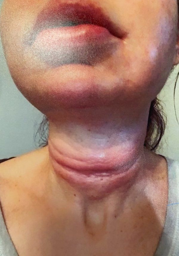 İstanbul'da estetik faciası! Lise mezunu doktor (!) tanınmaz hale getirdi - Resim: 3