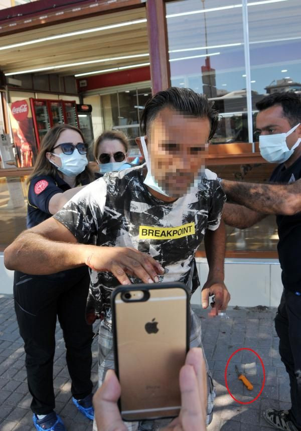 İnanılmaz görüntü! Sırtına saplı bıçakla, Almanya’daki ablasıyla görüntülü görüştü - Resim: 2