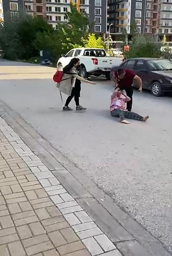 Eski eşinin sokak ortasında darbettiği kadın: Başkasının başına gelmesin - Resim: 1
