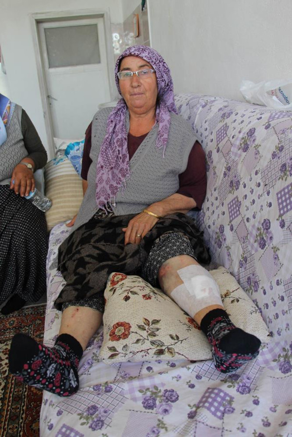 Nevşehir'de domates toplarken hayatının şokunu yaşadılar: Defalarca... - Resim: 0