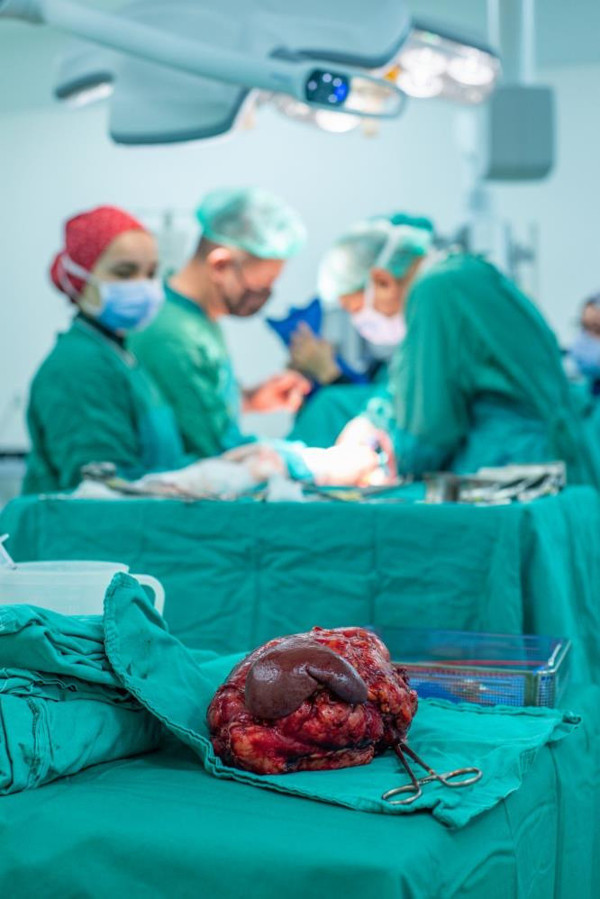 Karın ağrısı ve iştahsızlıkla hastanelere gitti! Şifayı Türkiye'de buldu: Hayati risk oluşturuyordu - Resim: 0