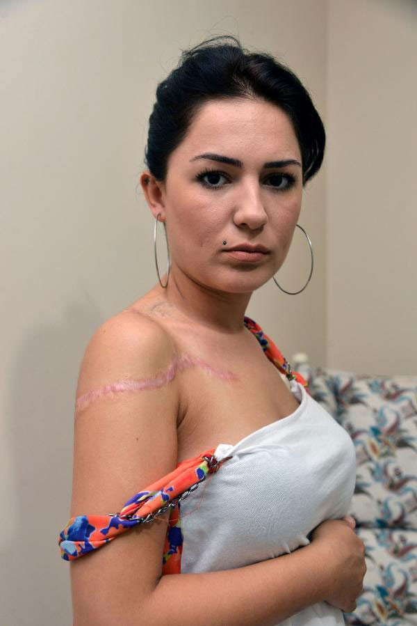 Şu hale bakın! Dövmelerinden kurtulmak istedi hayatı karardı - Resim: 3