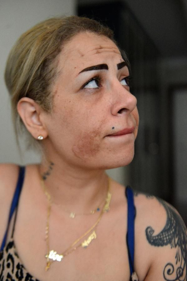 Adana'da para iadesi almak istedi hayatının hatasını yaptı!Evden dışarı çıkamıyor - Resim: 4