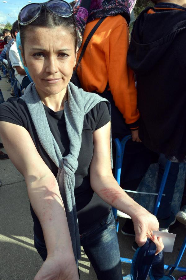 Derdini anlatmak için ağaca çıkmıştı! Erdoğan'la görüşen kadın muradına erdi - Resim: 4