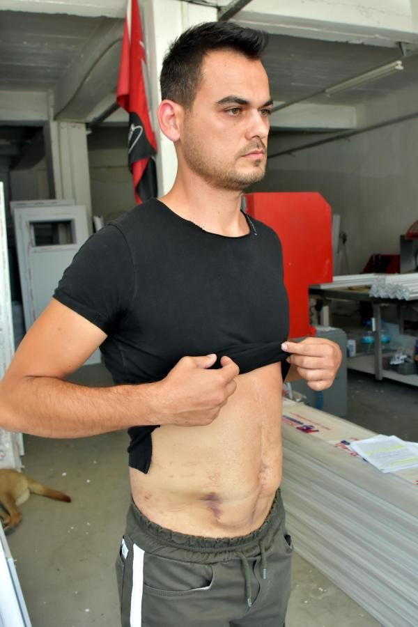 Kayınpederi tarafından vurulan damada büyük şok! 40 bin lira tazminat ödeyecek - Resim: 1