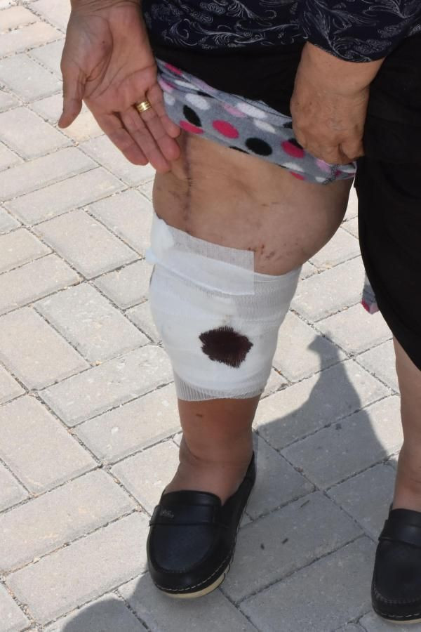 İzmir'de pitbull saldırısına uğrayan yaşlı kadın şaşırttı: Köpeğin bir suçu günahı yok - Resim: 4