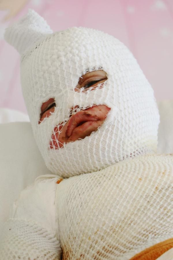 Konuşamıyor sadece ağlıyor! Kars'ta feci olay sonrası mumyaya döndü - Resim: 3