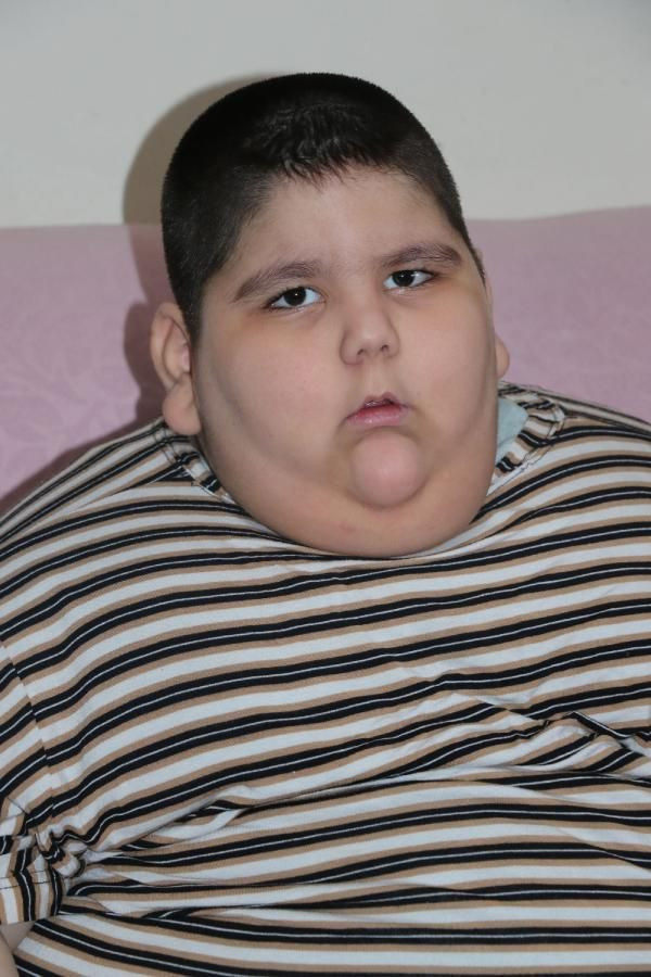 Yaşını duyan inanamadı! Samsun'da 4 kişi zor kaldırıyor ailenin hayatı kabusa döndü - Resim: 1