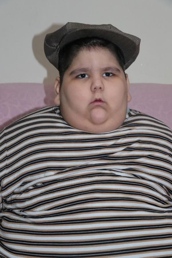 Yaşını duyan inanamadı! Samsun'da 4 kişi zor kaldırıyor ailenin hayatı kabusa döndü - Resim: 4