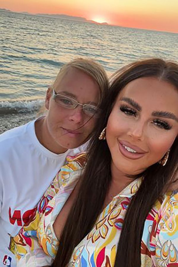 Antalya'ya diş estetiği yaptırmaya geldiler hayatları karardı! Ağızlarına koyamıyorlar... - Resim: 2