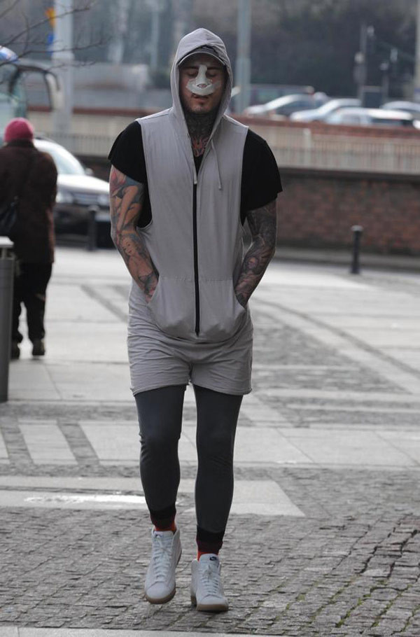 Sokakta sevgilisinin göğsünü ısırdı burnu düştü! - Resim: 3