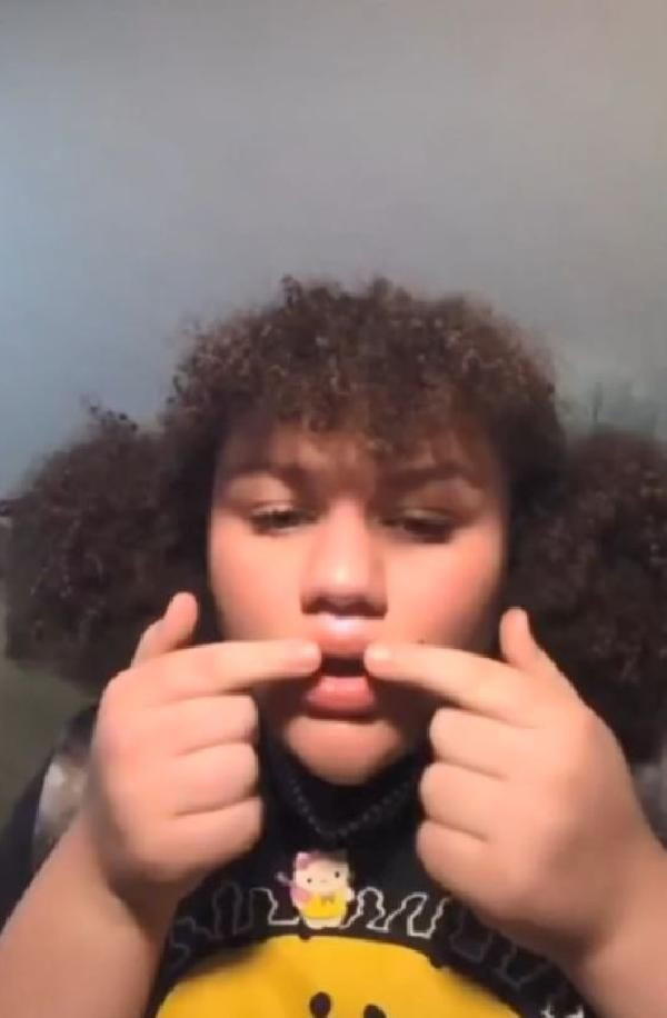 Şişeyle yapıp sosyal medyada paylaşıyorlar! 'Evde estetik' akımı tehlike saçıyor - Resim: 1