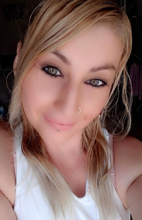 Güzellik uğruna 4 operasyon geçirdi hayatı kabusa döndü - Resim: 1