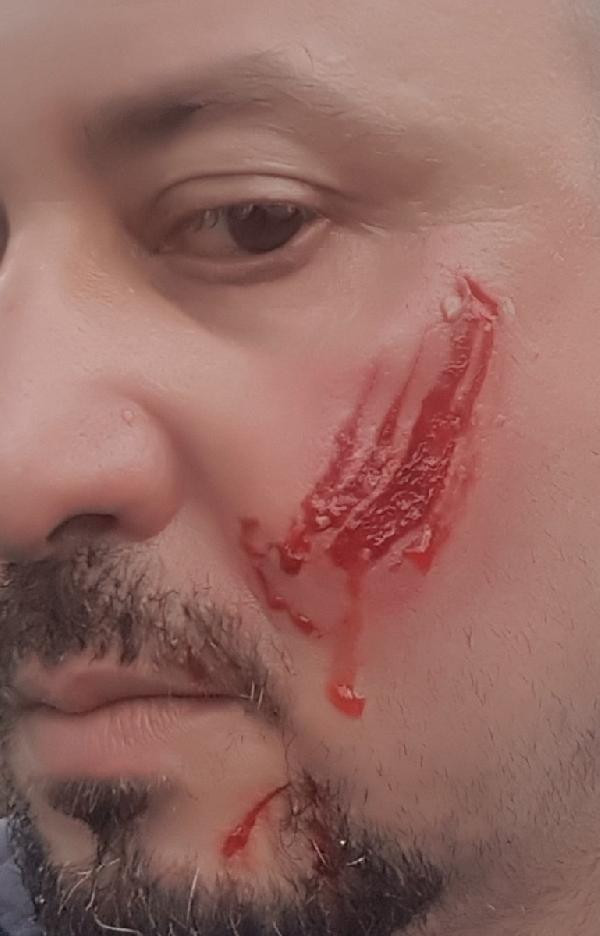 Avukat hayatının şokunu yaşadı: Yanağını kopardı! - Resim: 4