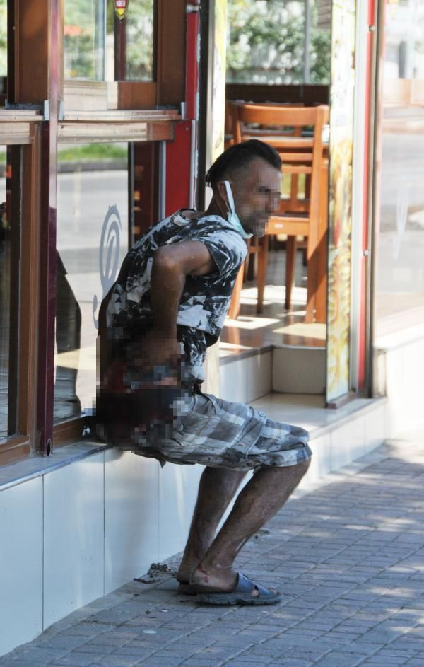 İnanılmaz görüntü! Sırtına saplı bıçakla, Almanya’daki ablasıyla görüntülü görüştü - Resim: 1