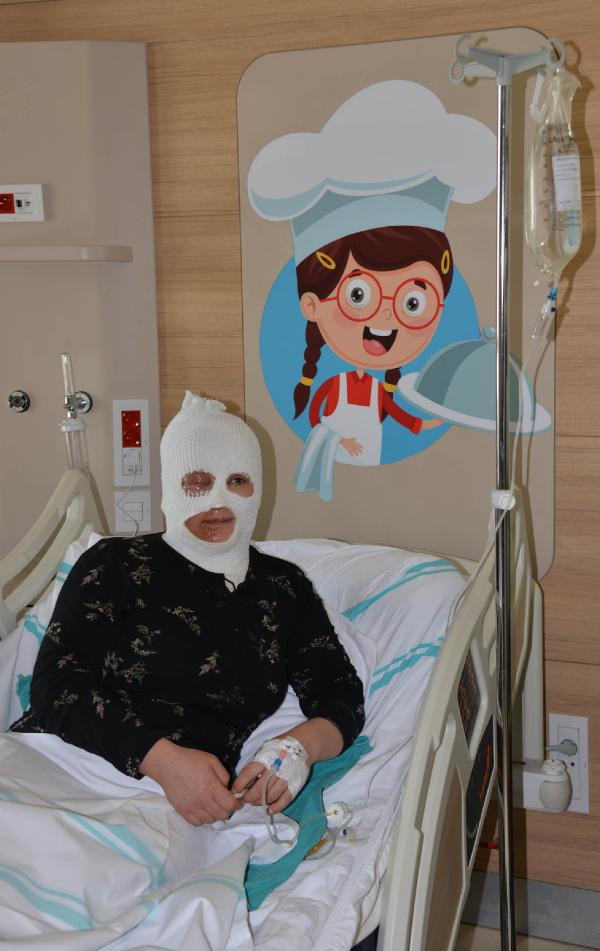 Olay yeri Bayburt! Demlediği çay üstüne dökülen kadın ağır yaralandı - Resim: 0