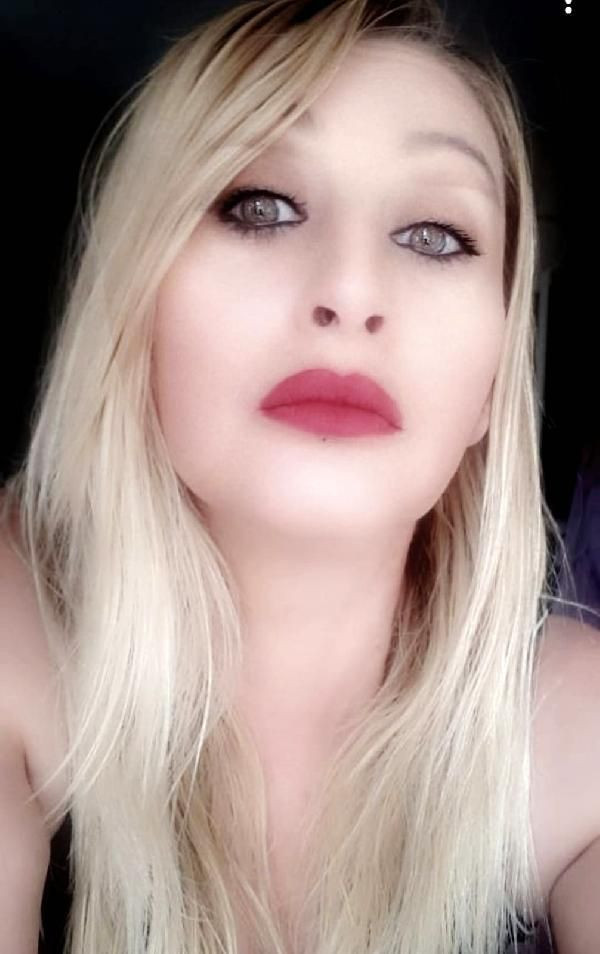 Güzellik uğruna 4 operasyon geçirdi hayatı kabusa döndü - Resim: 2