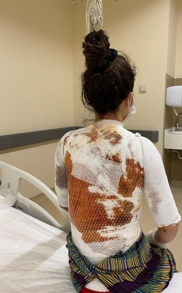 Konya'da eşiyle kızını kaynar suyla haşladı! Sözleri pes dedirtti: Aldığı ceza şaşırttı - Resim: 1