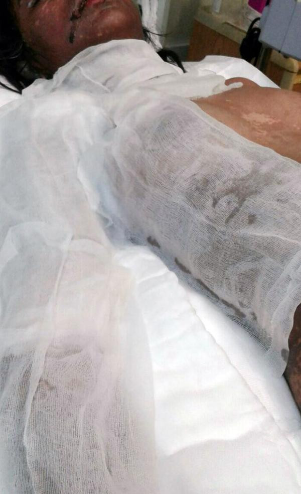 Liseli kızı bu hale getiren ne? Şok iddia - Resim: 1