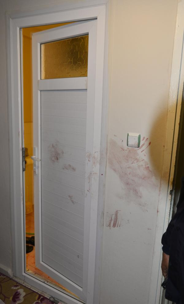 Uyurken yüzüne kızgın yağ döküp satırla vurmuştu! Bakın niye yapmış? - Resim: 4