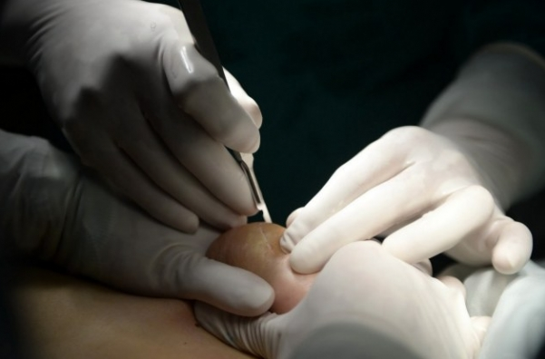 Silikon yaptırdığına yaptıracağına bin pişman oldu - Resim: 1