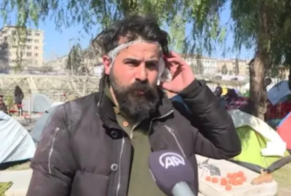 Türkiye'de o anları milyonlar izledi, başından duman yükselen adamın kulağı kopmuş - Resim: 1