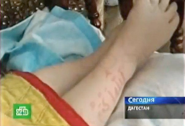 Mucize bebekteki şoke eden yazılar - Resim: 3