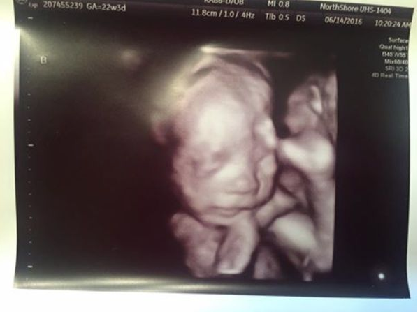 Eşi öldü ardından hamile olduğunu öğrendi gördükleri karşısında şoke oldu - Resim: 3