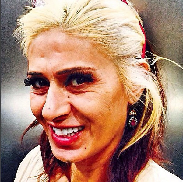 Yıldız Tilbe'nin son hali şok etti! Her yerine yayılıyor - Resim: 4