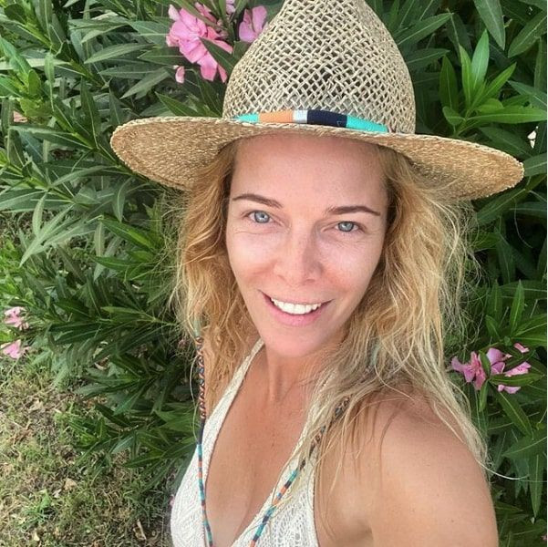 Begüm Kütük 'Çanağı kırdım' deyip başına gelen talihsiz kazayı anlattı - Resim: 2