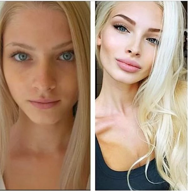 Fenomen olmak için estetik yaptırıyorlar - Resim: 3