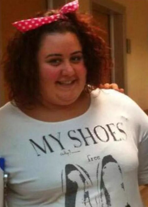 Mide ameliyatı sonrası 100 kilo veren Aslı Samat: Şişman bir kıza... - Resim: 4