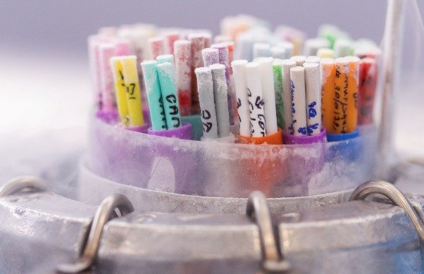 Sperm bankasından akılalmaz ilan sperm donörlerinden bunu istediler - Resim: 2