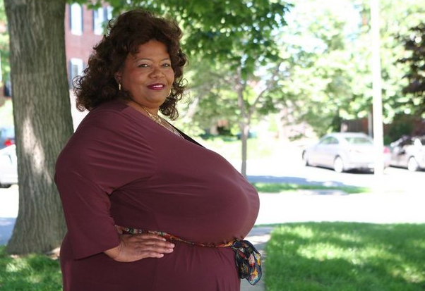 Dünyanın en büyük göğüslü kadını - Resim: 3