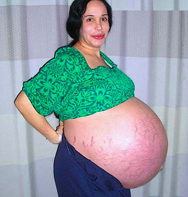 Aynı anda 8 bebek dünyaya getirdi gerçek daha sonra çıktı! - Resim: 1