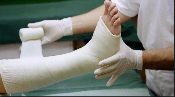 İşte kırıklar hakkında doğru bildiğimiz 5 yanlış! - Resim: 4