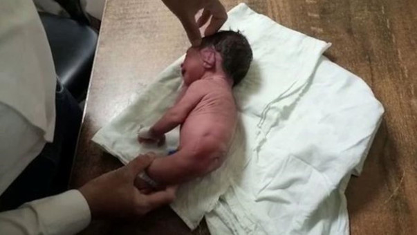 Boynuzla dünyaya geldi! Ayakları olmayan bebek şaşkına uğrattı - Resim: 1