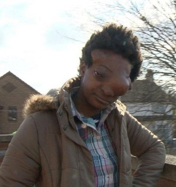 Onların hayatları çok zor! - Resim: 3