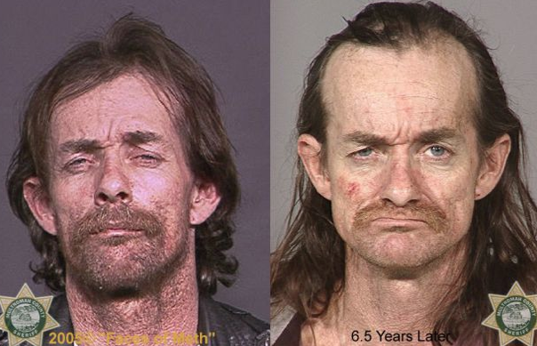 Uyuşturucu onları bu hale getirdi! - Resim: 4