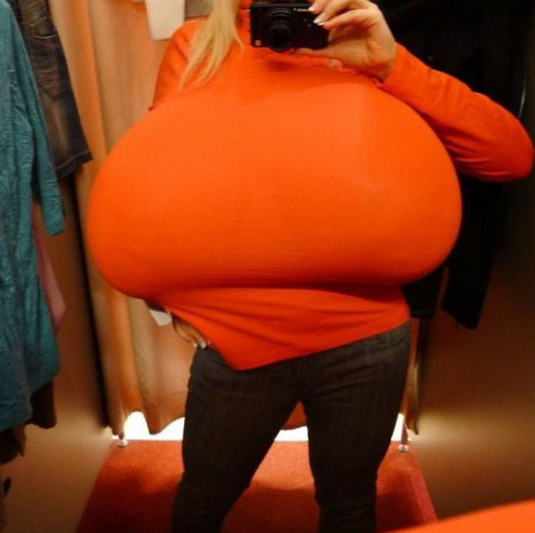 Bu kadının göğüsleri 50 kilo - Resim: 4