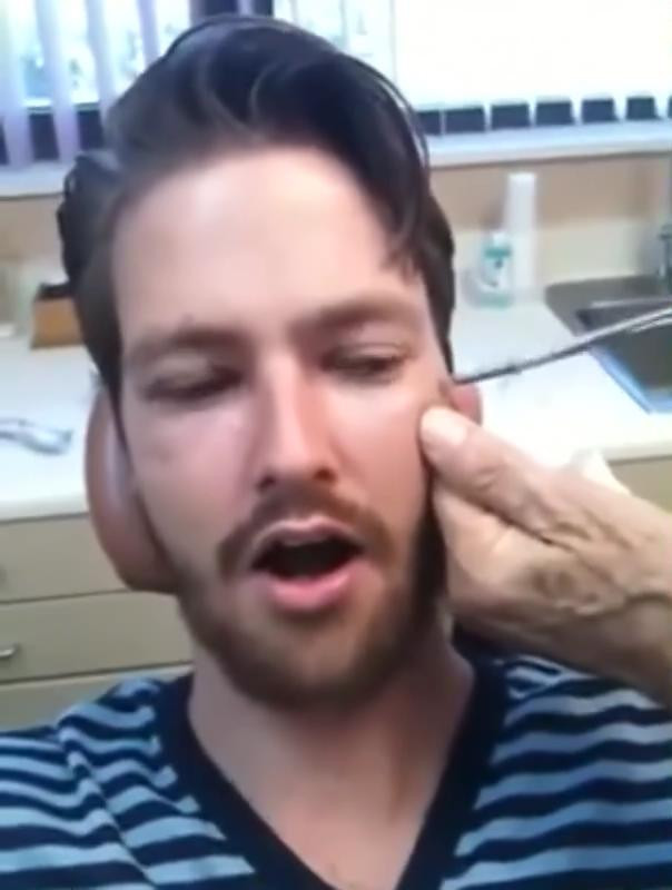 Yüzünden çıkanı görünce gözlerinize inanmayacaksınız - Resim: 3