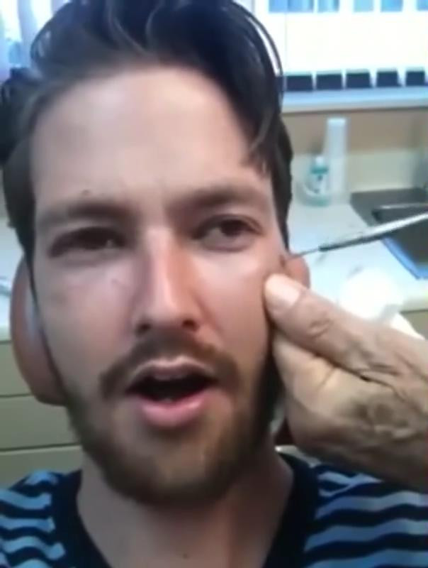 Yüzünden çıkanı görünce gözlerinize inanmayacaksınız - Resim: 4