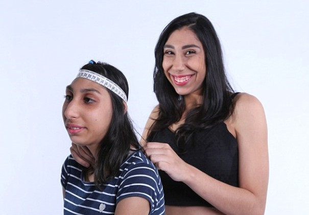 Doktorlar asla yürüyemez dedi o şimdi manken oldu - Resim: 3